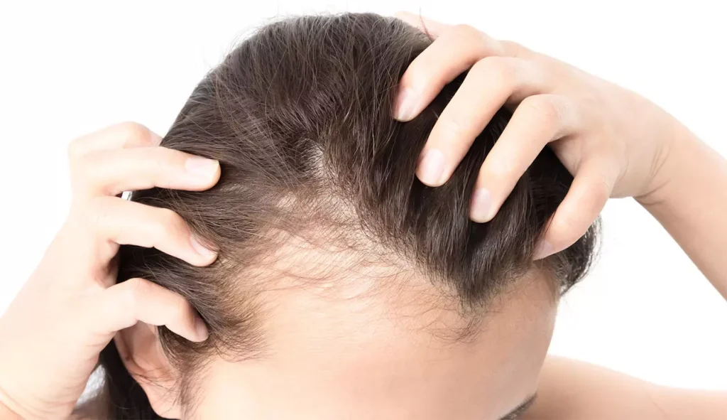 a man holding his hair with both hands